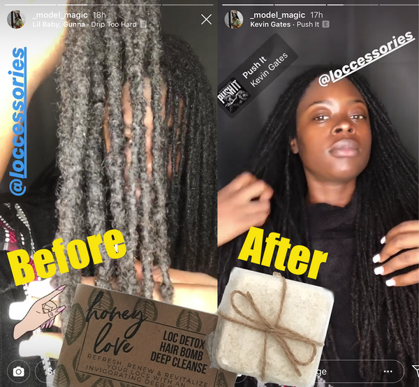 Loc Detox Deep Cleanse Hair Bombs - Loccessories™